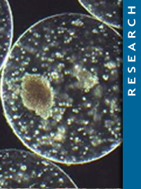 Multifunctional microcapsules for islets entrapment