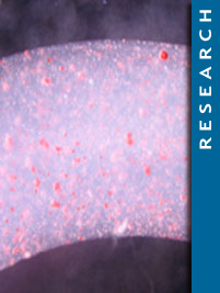 Conduits for nerve repair