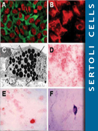Encapsulation of Sertoli cells